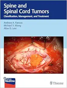 Spine and Spinal Cord Tumors: Classification, Management, and Treatment (Original PDF from Publisher)
