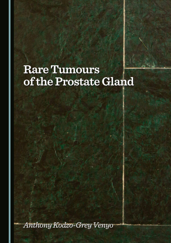 Rare Tumours of the Prostate Gland (Original PDF from Publisher)